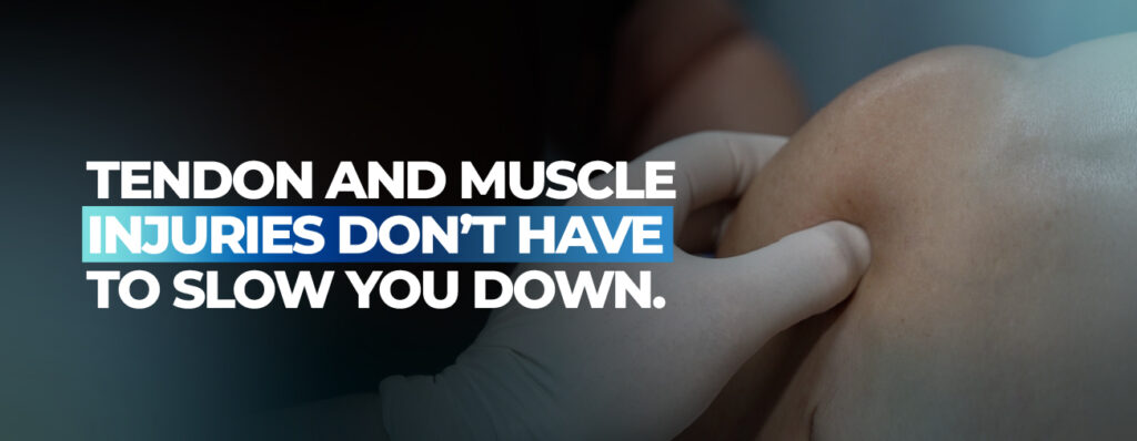 Muscle Tears, Tendon Injuries, and Regenerative Solutions Explained
