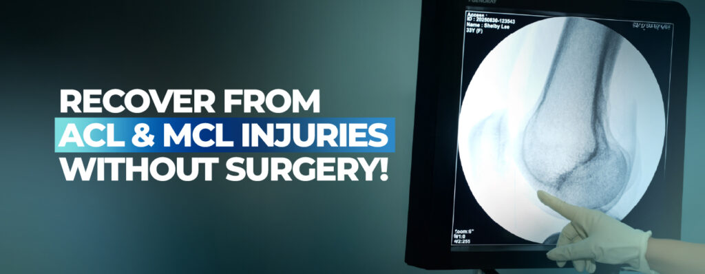 Recovering from ACL or MCL Injuries Without Surgery: Essential Non-Surgical Strategies