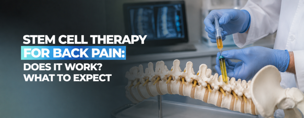 Stem Cell Therapy for Back Pain Does It Work What to Expect
